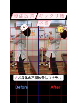 ヒデ整体院(Hide整体院)/反り腰改善&骨盤矯正コース