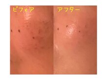 エステ ド あーと/before/after