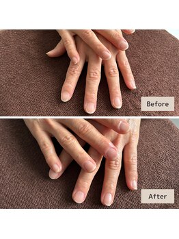 ワンランク上の保湿ケア