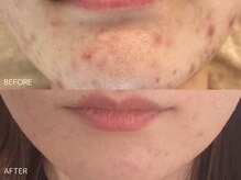 エムフローラ(M.flora)の雰囲気(毛穴洗浄&リブセラで肌悩み解消!)