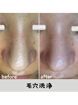 ルアナ 北谷店/毛穴洗浄毛穴ケア 《沖縄/北谷》