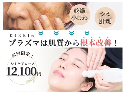 キレイ(KIREI)の写真