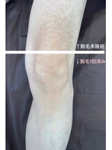 ミーフォレスト(Mi Forest)/