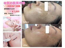 クリスタル(Crystal)