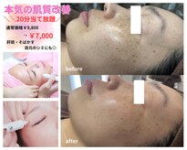 クリスタル(Crystal)