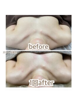 ビオラ(美ola)/バストアップしやすいお身体へ