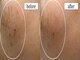 スハダボーテ(Suhada-beaute)の写真