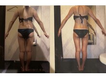 パーフェクトボディプレミアム 札幌大通店(PERFECT BODY PREMIUM)/お客様　ビフォーアフター（14）