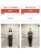 レピア 夙川本店(Lepia)/ビフォーアフターのご紹介♪