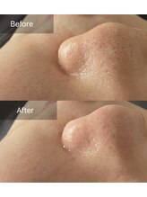 ハートランド(HEARTLAND)/毛穴のない肌をつくる！