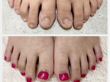 グラシナ 鳥丸店/足のむしりもお任せください