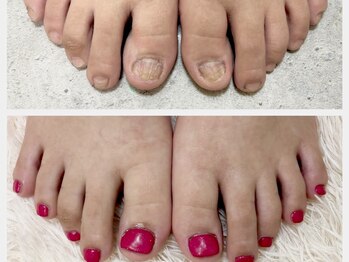 グラシナ 鳥丸店/足のむしりもお任せください