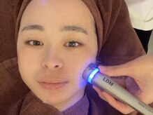 ビューティーワン(Beautyone)/@rinrin934様ご来店☆