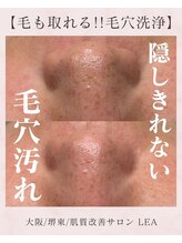 レア(Lea)/浮いた汚れをしっかり除去＊