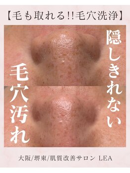 レア(Lea)/浮いた汚れをしっかり除去＊