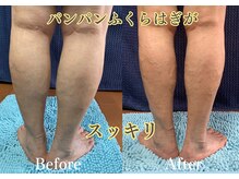 ケイ プレジール/浮腫みスッキリ炭酸フットケア