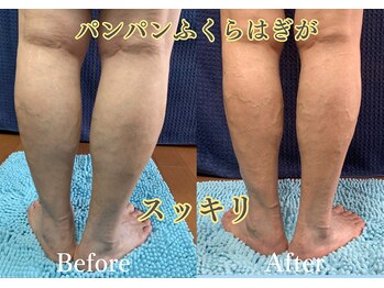 ケイ プレジール/浮腫みスッキリ炭酸フットケア