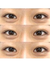 フィービー(pheebe)/ラッシュリフト(まつ毛パーマ)