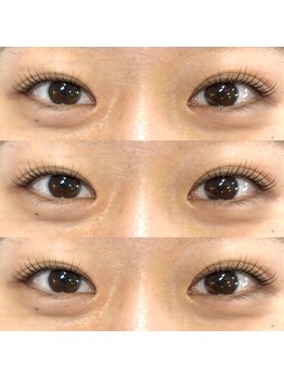 フィービー(pheebe)/ラッシュリフト(まつ毛パーマ)