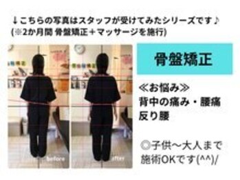 すずらんスタイル鍼灸整体院 阿佐ヶ谷院/骨盤矯正