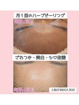 ウィズユー(with U)/シワ改善しトーンUP