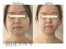 プレジール(Plaisir)の雰囲気（広島初導入【韓国華奢見えコルギ】圧倒的な結果出しの小顔矯正）