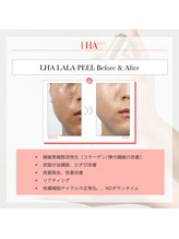 ラメール(La_mer)/韓国女優の秘密【ララピール】