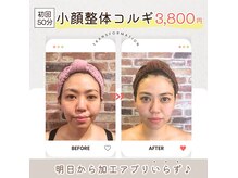 小顔整体研究所 KSラボ 荒川熊野前店の雰囲気（創業13周年!!100万人の施術実績★安心と信頼の【KSラボ】）