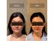 ビアライン オオサカ(Be align Osaka)の写真