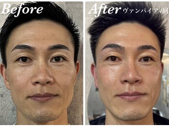 ミランオオサカ(MIRAN OSAKA)/