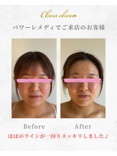 シュシュ(Chouchou)/パワーレメディ1回