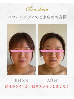 シュシュ(Chouchou)/パワーレメディ1回