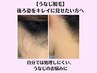 【脱毛】　うなじ脱毛　　後姿は　姿勢とうなじできまる！　￥2090