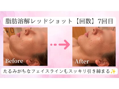 ラ リリー ステラ(La Lily stella)の写真