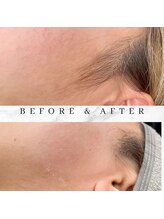 ユアアイサロン(ur.eyesalon)/もみあげWax(フェイシャルWax)