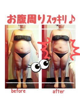 ビューティサロン キヨの部屋(beauty salon)/【筋膜リリース】 １回