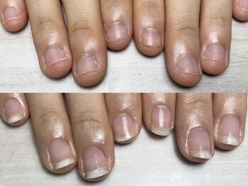 ロイ(LOI)/自爪育成コース