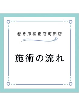 巻き爪補正店 町田店/施術までの流れ