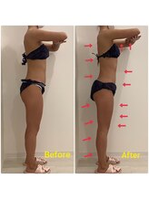 スペチアーレ 夙川/ハイパーナイフで代謝UP