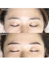 アイリー(IRIE)/ハリウッドブロウリフト