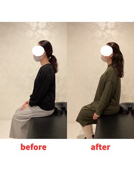 ナオル整体 福岡香椎院(NAORU整体)/50代女性施術事例【姿勢改善】