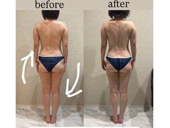 シェリーナ(cherieNa)/お尻痩せこそ骨格から整えて