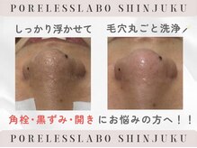 ポアレスラボ 新宿マルイ本館店の雰囲気（毛穴トラブル改善コスメで角栓をしっかり浮かせて洗浄☆彡）