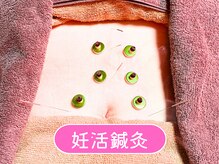 仁接骨院 じん鍼灸治療院/マタニティ鍼灸(お腹＋あお向け)