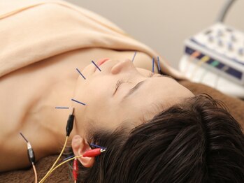 ハリキュア(H.a.r.i C.u.r.e.)の写真/美容鍼でツボを刺激,筋肉をほぐし食いしばり解消,リフトUP!微弱電流付で頭から自律神経が整う快感♪