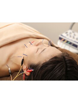 鍼灸施術を受けたい