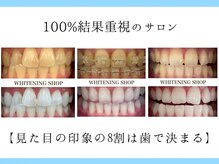 ホワイトニングショップ 倉敷店