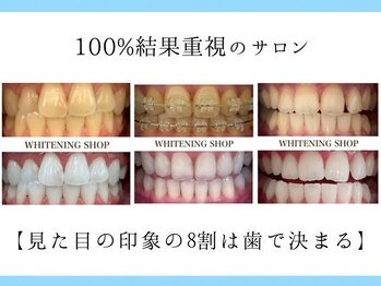 ホワイトニングショップ 倉敷店