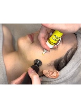 小顔になりたい