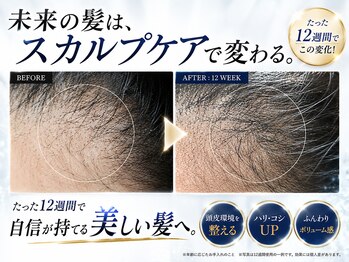 BLD/クリニカルスカルプケアB&A